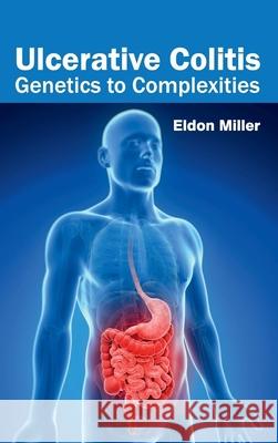 Ulcerative Colitis: Genetics to Complexities Eldon Miller 9781632424143 Foster Academics - książka