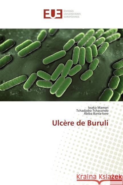 Ulcère de Buruli Maman, Issaka; Tchacondo, Tchadjobo; Banla-kere, Abiba 9786138447351 Éditions universitaires européennes - książka