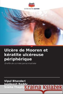 Ulcère de Mooren et kératite ulcéreuse périphérique Bhandari, Vipul, Reddy, Jagdeesh, Thapliyal, Sneha 9786209220593 Editions Notre Savoir - książka