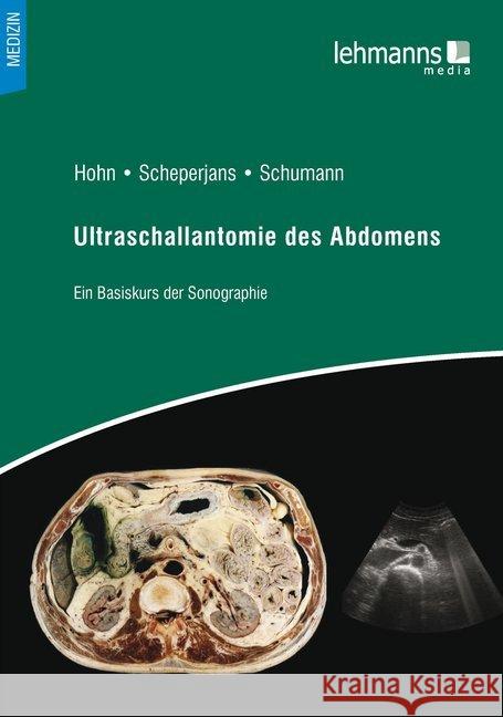 Ultraschall des Abdomens : Ein Basiskurs der Sonografie  9783865417923 Lehmanns Media - książka