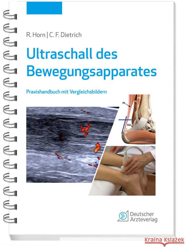 Ultraschall des Bewegungsapparates Horn, Rudolf, Dietrich, Christoph F. 9783769137668 Deutscher Ärzte-Verlag - książka