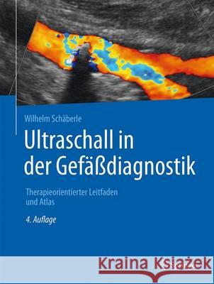 Ultraschall in Der Gefäßdiagnostik: Therapieorientierter Leitfaden Und Atlas Schäberle, Wilhelm 9783662474310 Springer - książka