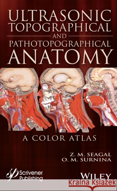 Ultrasonic Topographical and Pathotopographical Anatomy: A Color Atlas Julia V. Karakeyan 9781119223573 Wiley-Scrivener - książka