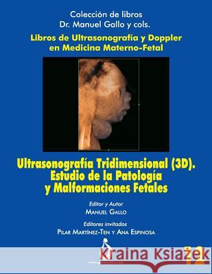 Ultrasonografía Tridimensional (3d). Estudio de la Patología Y Malformaciones Fetales Padilla, Jose 9781731579898 Independently Published - książka