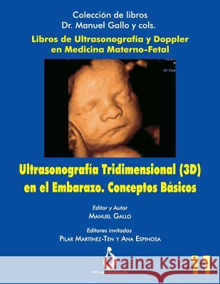 Ultrasonografia Tridimensional En El Embarazo (3d). Conceptos Básicos Padilla, Jose 9781731579478 Independently Published - książka
