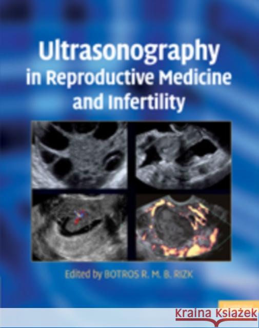 Ultrasonography in Reproductive Medicine and Infertility Botros R M B Rizk 9780521509763  - książka