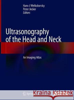 Ultrasonography of the Head and Neck: An Imaging Atlas Welkoborsky, Hans J. 9783030126407 Springer - książka