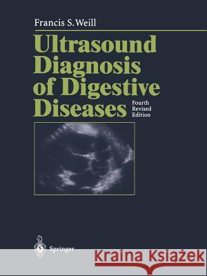 Ultrasound Diagnosis of Digestive Diseases P. J. S. Valette 9783642646690 Springer - książka