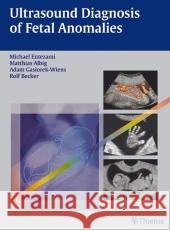 Ultrasound Diagnosis of Fetal Anomalies Michael Entezami, M.D. Adam Gasiorek-Wiens Prof. Rolf Becker, M.D. 9783131318619 Thieme Publishing Group - książka