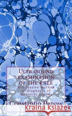 Ultrasound examination of the knee: Alternative method of diagnosis of meniscus lesions Constantin Panow 9781500131869 Createspace Independent Publishing Platform - książka