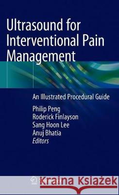 Ultrasound for Interventional Pain Management: An Illustrated Procedural Guide Peng, Philip 9783030183707 Springer - książka