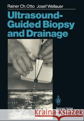 Ultrasound-Guided Biopsy and Drainage Rainer C. Otto Josef Wellauer T. C. Telger 9783642709913 Springer - książka