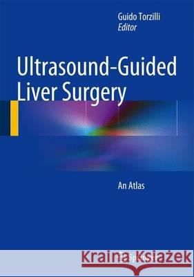 Ultrasound-Guided Liver Surgery: An Atlas Torzilli, Guido 9788847055094 Springer - książka