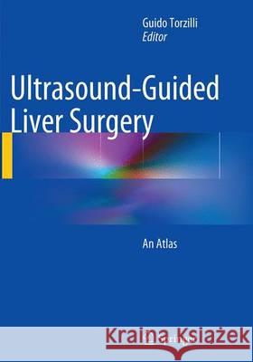 Ultrasound-Guided Liver Surgery: An Atlas Torzilli, Guido 9788847058323 Springer - książka