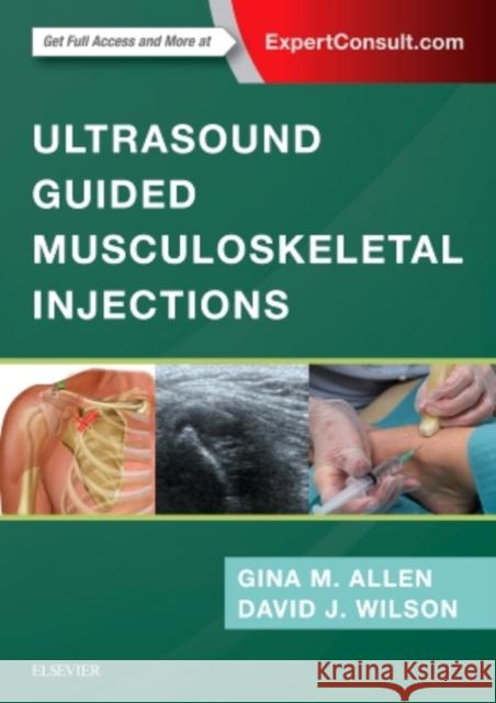 Ultrasound Guided Musculoskeletal Injections Gina M. Allen David John Wilson 9780702073144 Elsevier - książka