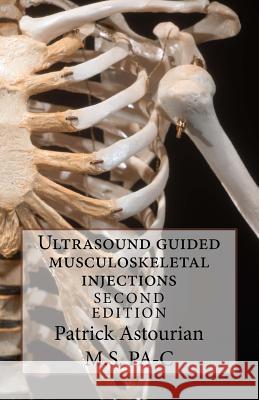 Ultrasound Guided Musculoskeletal Injections Patrick Astourian 9781466307704 Createspace - książka