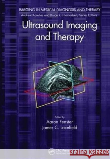 Ultrasound Imaging and Therapy Aaron Fenster James C. Lacefield 9781138894358 CRC Press - książka