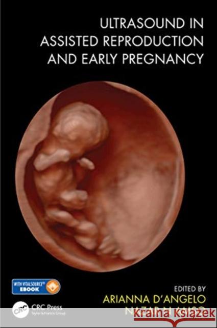 Ultrasound in Assisted Reproduction and Early Pregnancy Arianna D'Angelo Nazar Amso 9781138485853 CRC Press - książka