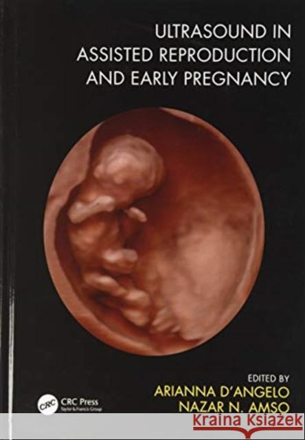 Ultrasound in Assisted Reproduction and Early Pregnancy Arianna D'Angelo Nazar Amso 9781138486171 CRC Press - książka