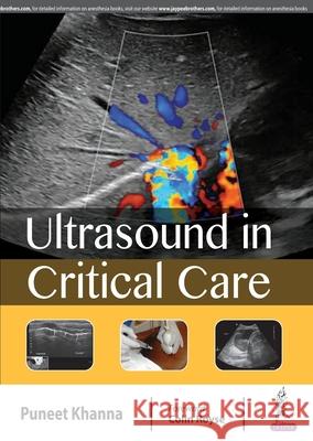 Ultrasound in Critical Care Puneet Khanna 9789352701681 Jp Medical Ltd - książka