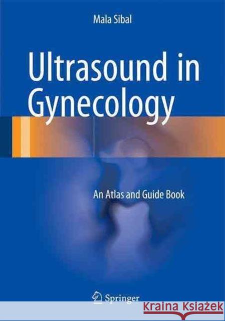 Ultrasound in Gynecology: An Atlas and Guide Sibal, Mala 9789811027130 Springer - książka
