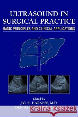 Ultrasound in Surgical Practice : Basic Principles and Clinical Applications Dennis B. Wisher Jay K. Harness Dennis B. Wisher 9780471245384 Wiley-Liss - książka