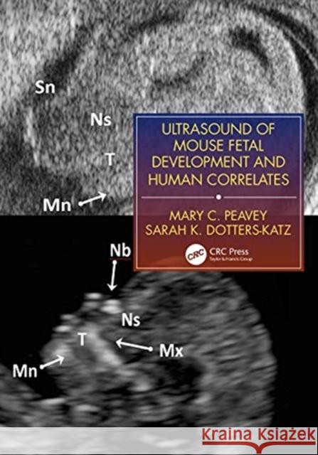 Ultrasound of Mouse Fetal Development and Human Correlates Peavey, Mary C. 9781138071216 Taylor & Francis Ltd - książka