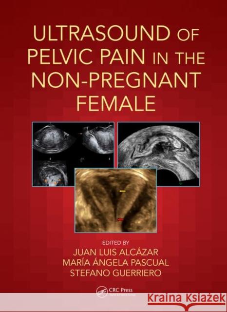 Ultrasound of Pelvic Pain in the Non-Pregnant Patient Juan Luis Alcazar Maria Angela Pascual Stefano Guerriero 9780815364979 CRC Press - książka