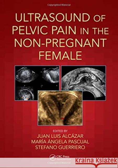 Ultrasound of Pelvic Pain in the Non-Pregnant Patient Juan Luis Alcazar Maria Angela Pascual Stefano Guerriero 9780815364993 CRC Press - książka