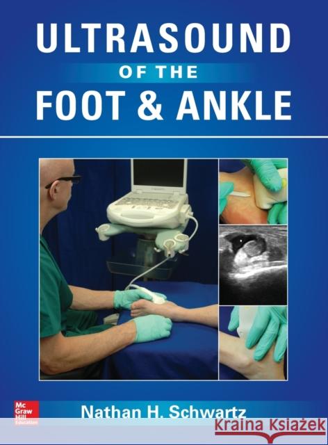 Ultrasound of the Foot and Ankle Nathan Schwartz 9780071831086 MCGRAW-HILL Professional - książka