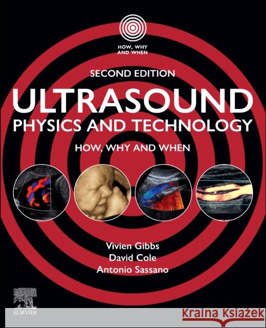 Ultrasound Physics and Technology: How, Why and When Vivien Gibbs David Cole Antonio Sassano 9780443409233 Elsevier - książka