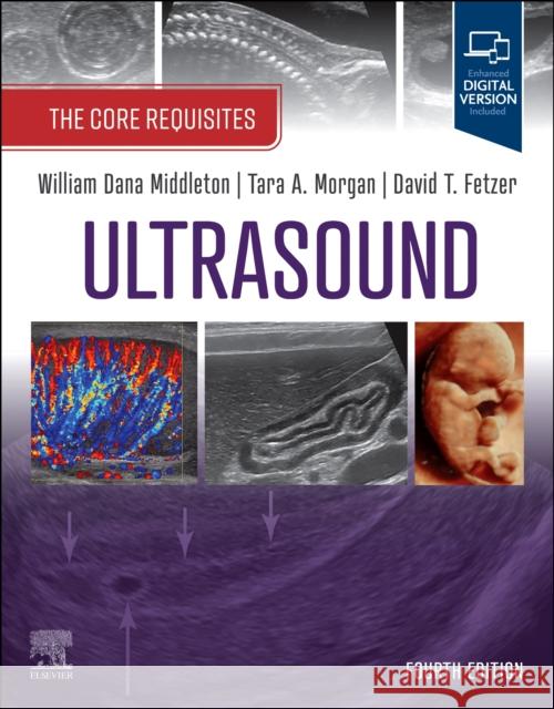 Ultrasound: The Core Requisites: The Core Requisites William D. Middleton Tara Morgan David Fetzer 9780323878074 Elsevier - książka