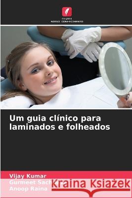 Um guia clínico para laminados e folheados Kumar, Vijay 9786205303740 Edicoes Nosso Conhecimento - książka