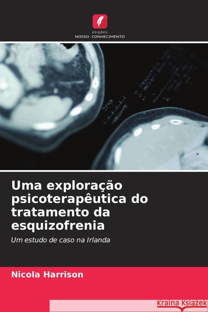 Uma explora??o psicoterap?utica do tratamento da esquizofrenia Nicola Harrison 9786207271290 Edicoes Nosso Conhecimento - książka