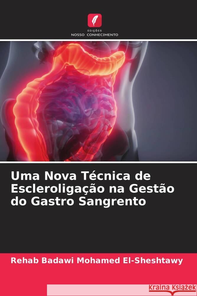 Uma Nova Técnica de Escleroligação na Gestão do Gastro Sangrento El-Sheshtawy, Rehab Badawi Mohamed 9786204641638 Edições Nosso Conhecimento - książka