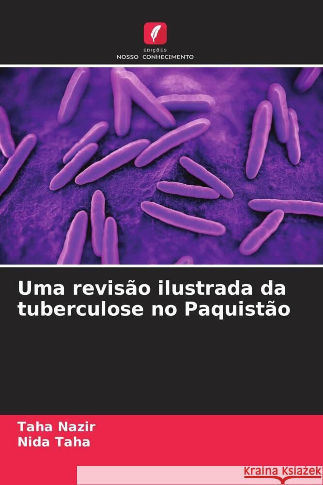 Uma revisão ilustrada da tuberculose no Paquistão Nazir, Taha, Taha, Nida 9786208599706 Edições Nosso Conhecimento - książka