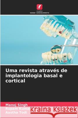 Uma revista através de implantologia basal e cortical Manoj Singh, Rupam Kumari, Aastha Todi 9786204124391 Edicoes Nosso Conhecimento - książka