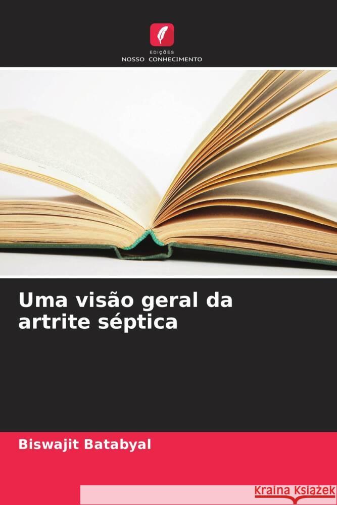 Uma vis?o geral da artrite s?ptica Biswajit Batabyal 9786207434985 Edicoes Nosso Conhecimento - książka