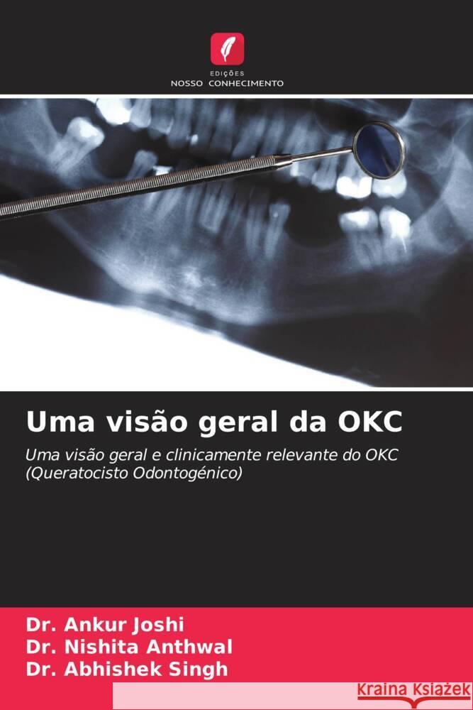 Uma visão geral da OKC Joshi, Dr. Ankur, Anthwal, Dr. Nishita, Singh, Dr. Abhishek 9786204811932 Edições Nosso Conhecimento - książka