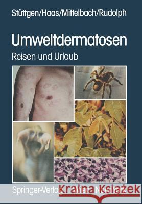 Umweltdermatosen: Reisen Und Urlaub Stüttgen, G. 9783709186534 Springer - książka