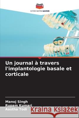 Un journal à travers l'implantologie basale et corticale Manoj Singh, Rupam Kumari, Aastha Todi 9786204126647 Editions Notre Savoir - książka