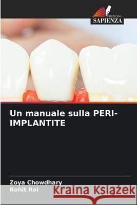 Un manuale sulla PERI-IMPLANTITE Chowdhary, Zoya, Rai, Rohit 9786209333408 Edizioni Sapienza - książka