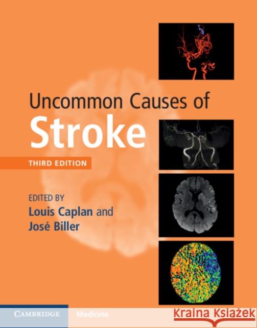 Uncommon Causes of Stroke Louis Caplan Jose Biller 9781107147447 Cambridge University Press - książka