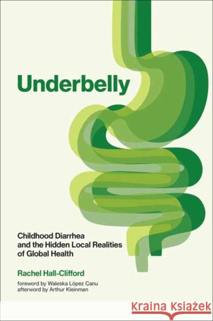 Underbelly: Childhood Diarrhea and the Hidden Local Realities of Global Health Rachel Hall-Clifford Arthur Kleinman Waleska Lopez Canu 9780262547765 MIT Press - książka