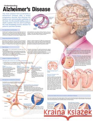 Understanding Alzheimer's Disease Anatomical Chart  Anatomical Chart Company 9780781786331  - książka