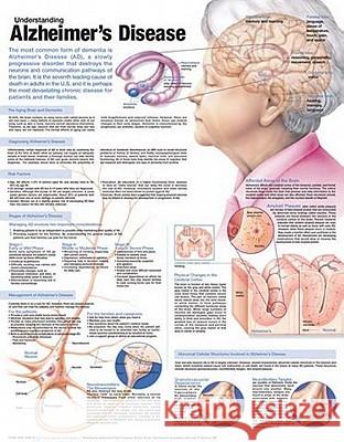 Understanding Alzheimer's Disease Anatomical Chart Acc                                      Anatomical Chart Company 9780781786348 Lippincott Williams & Wilkins - książka