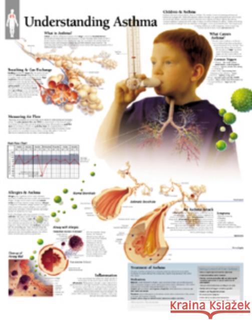 Understanding Asthma Laminated Poster Scientific Publishing 9781930633179 SCIENTIFIC PUBLISHING - książka