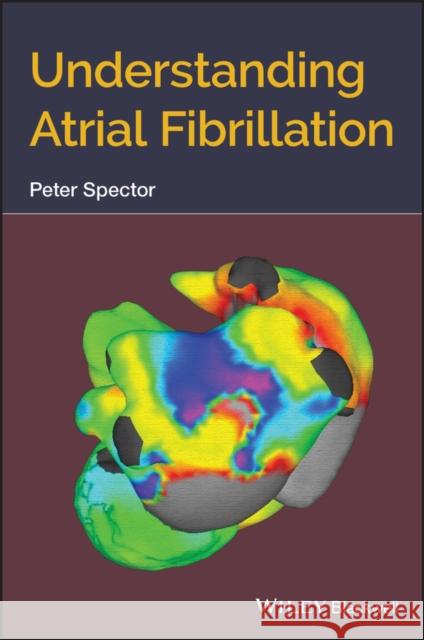 Understanding Atrial Fibrillation Spector, Peter 9781119524601 Wiley-Blackwell - książka