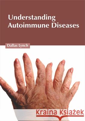 Understanding Autoimmune Diseases Dallas Lynch 9781632428479 Foster Academics - książka