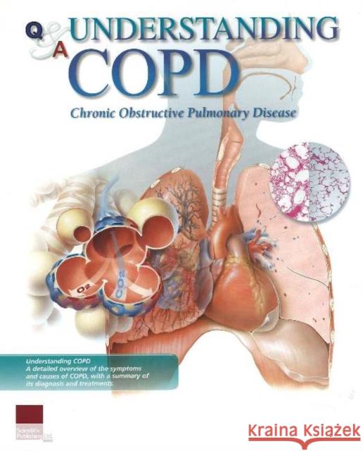 Understanding COPD Flip Chart Scientific Publishing 9781932922295 Scientific Publishing - książka